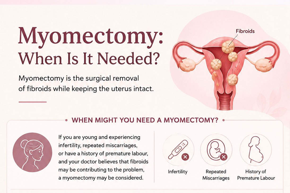 Myomectomy